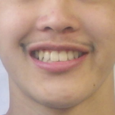 After