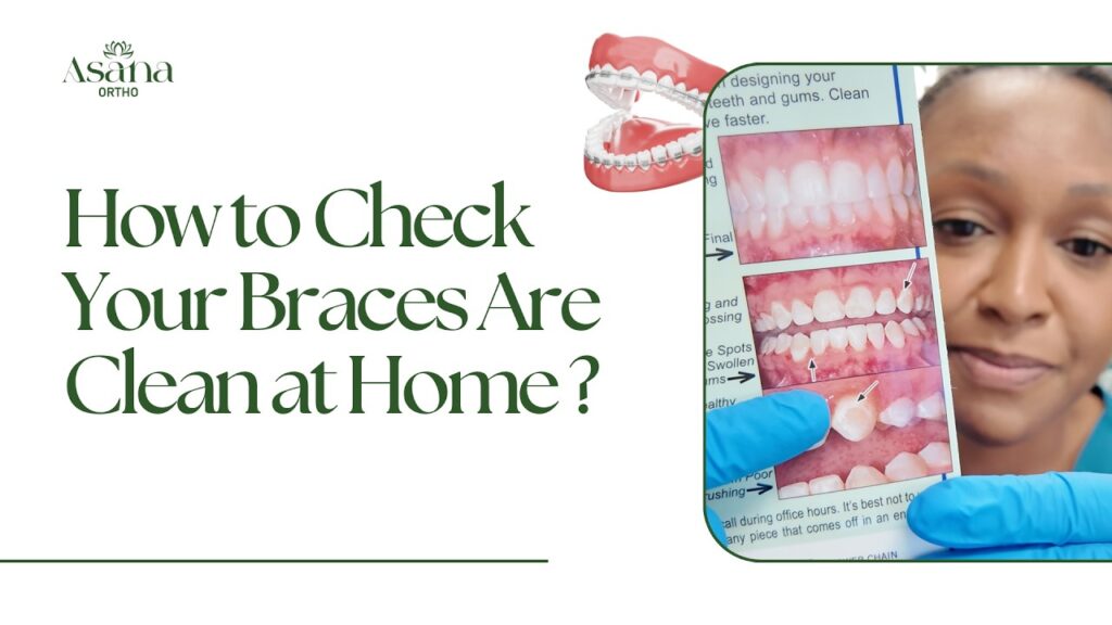 Are Your Braces Really Clean? Try This Check