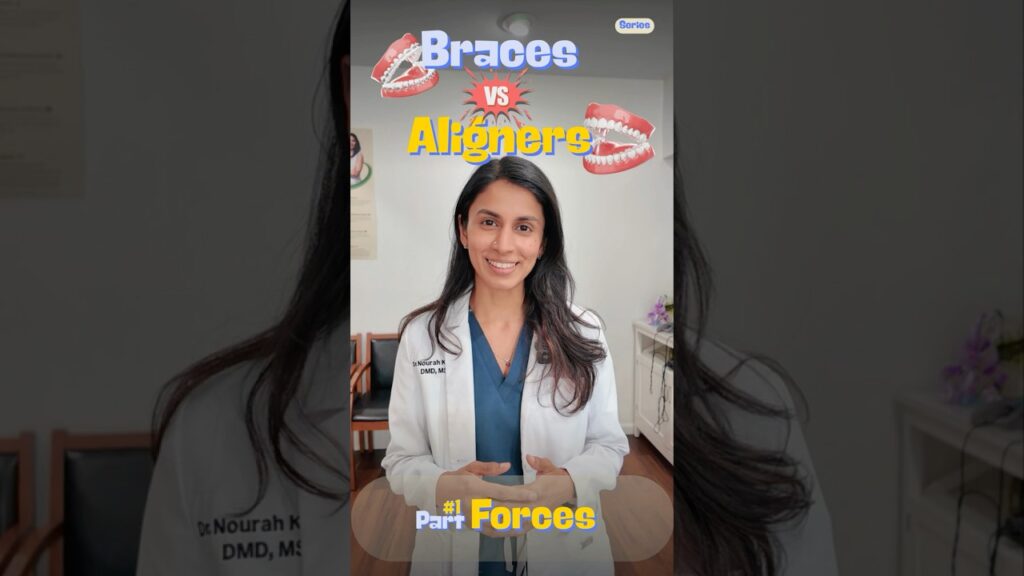 Braces vs Aligners – Part 01