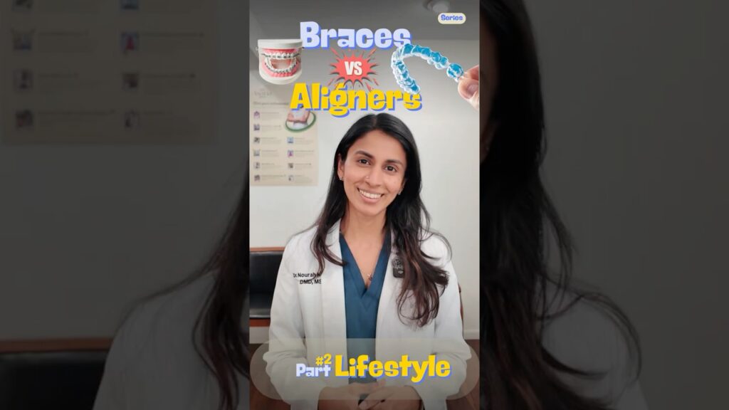 Braces vs Aligners – Part 02