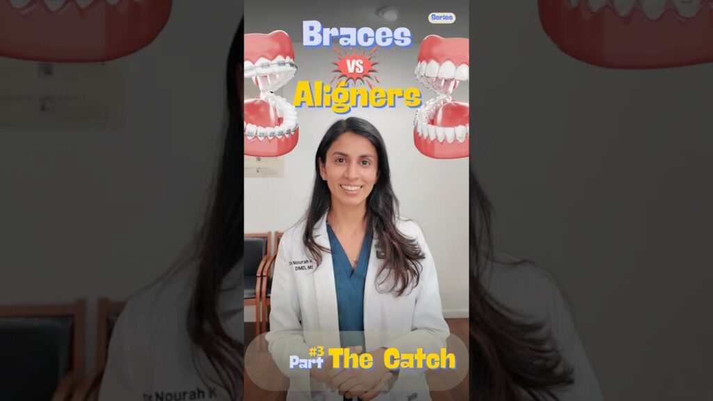 Braces vs Aligners – Part 03