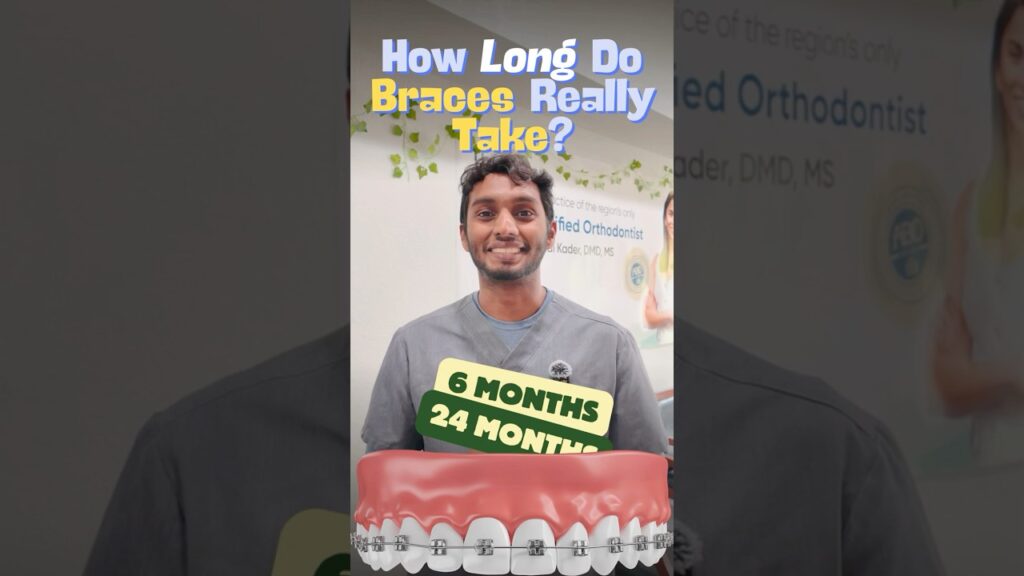 How long do braces actually take?