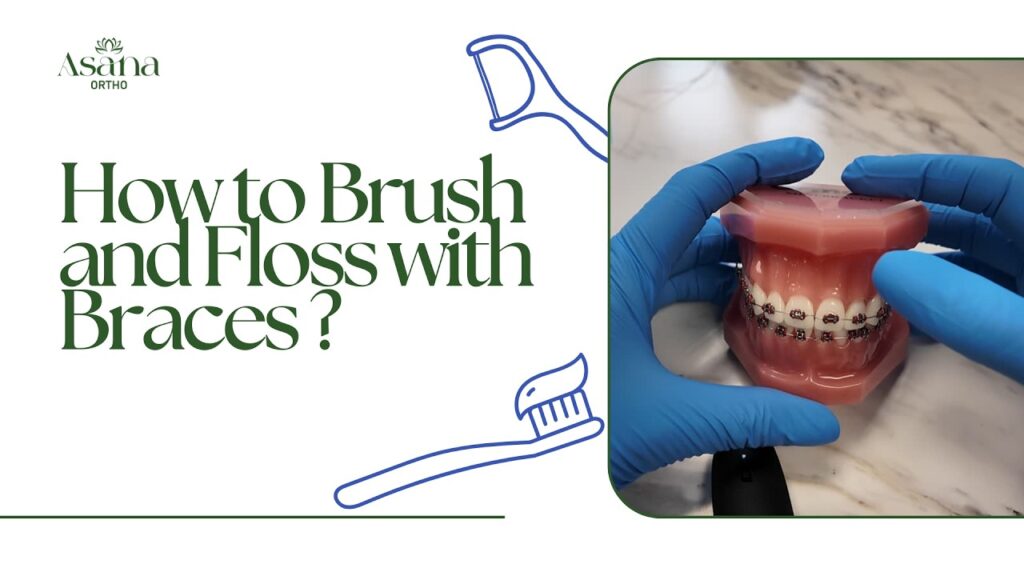 How to Brush and Floss with Braces | Asana Ortho
