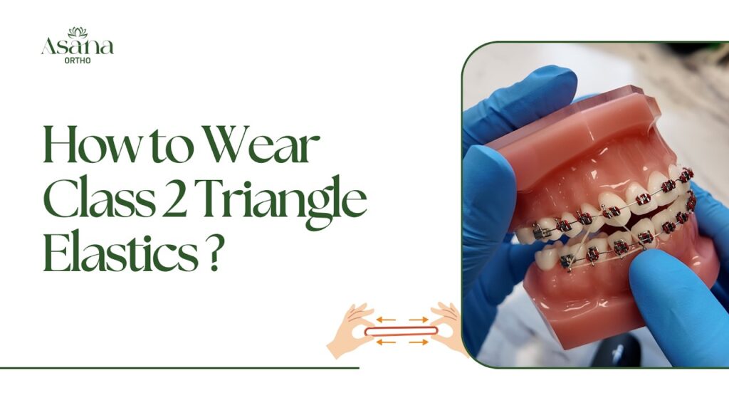 How to Wear Class 2 Triangle Elastics?
