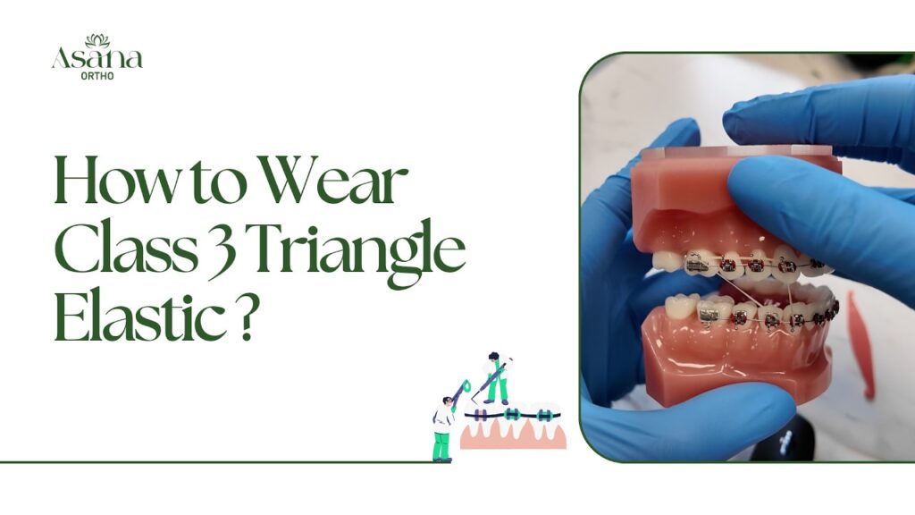 How to Wear Class 3 Triangle Elastic?