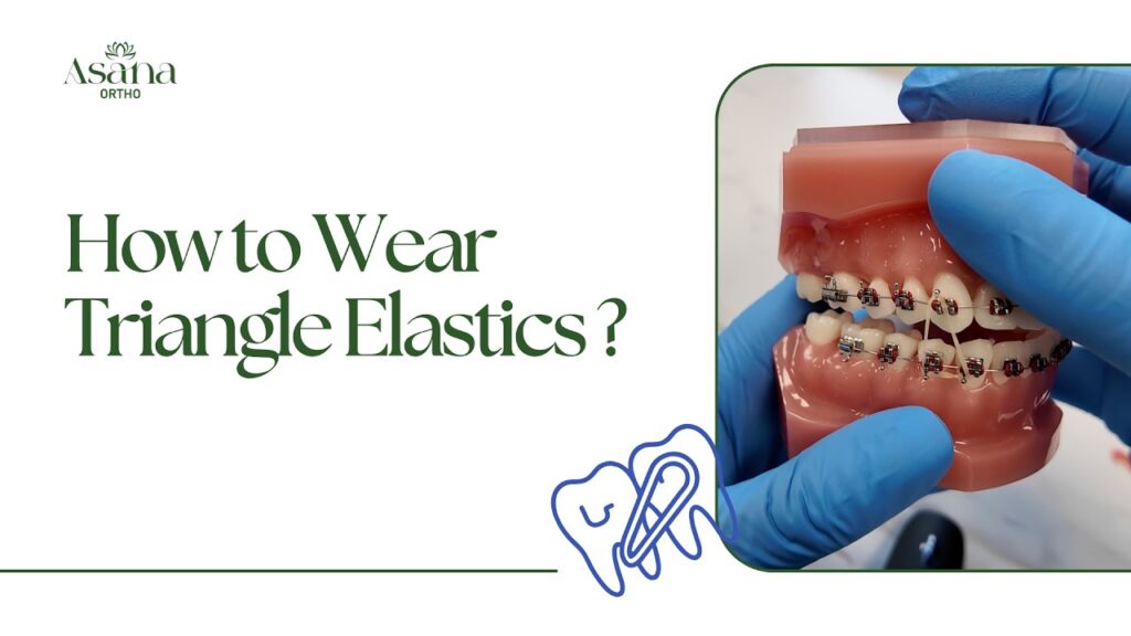 How to Wear Triangle Elastics?
