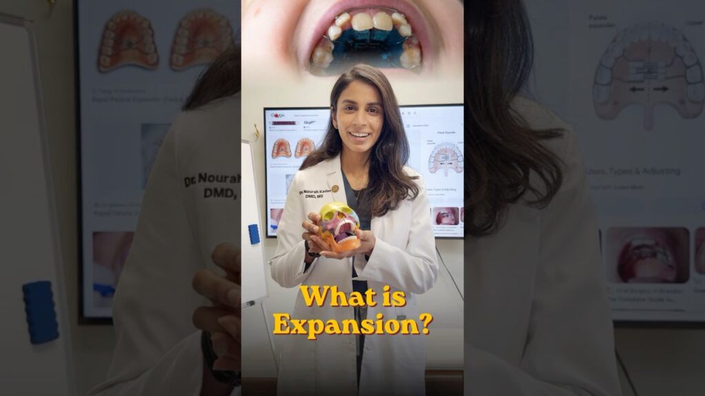 What is Expansion?