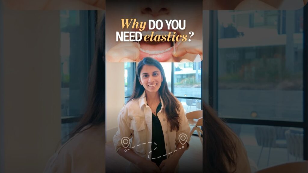 Why Do You Need Elastics for Your Teeth?