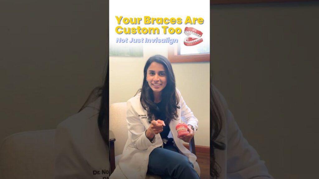 Your Braces Are Custom Too (Not Just Invisalign)